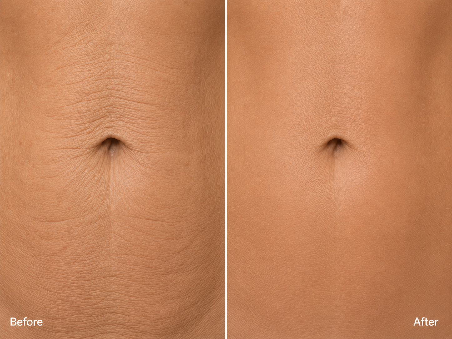 Arms, Legs & Belly Sculpting